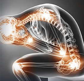 Rheumatoid Arthritis