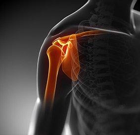 Internal Impingement of the Shoulder